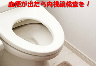 c-hemorrhoids7.jpg