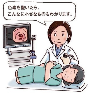 大腸がん検査